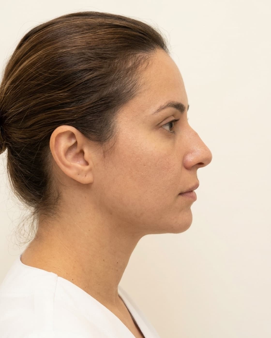 Perfil de uma mulher mostrando o dorso e a ponta do nariz