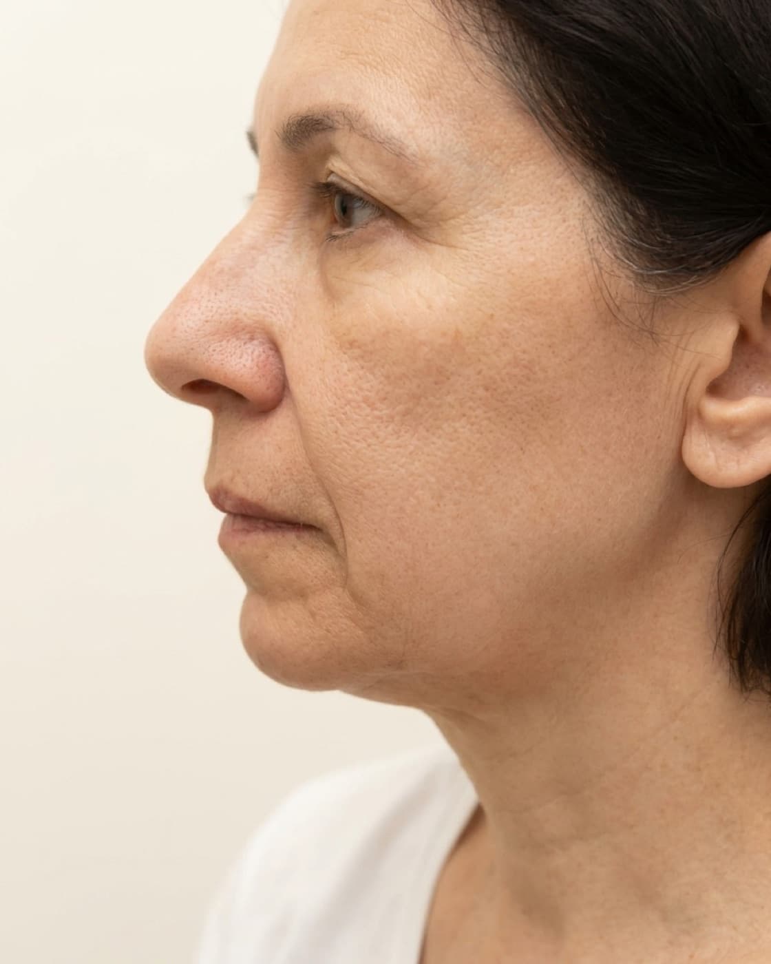 Mulher de perfil com pele opaca e textura irregular