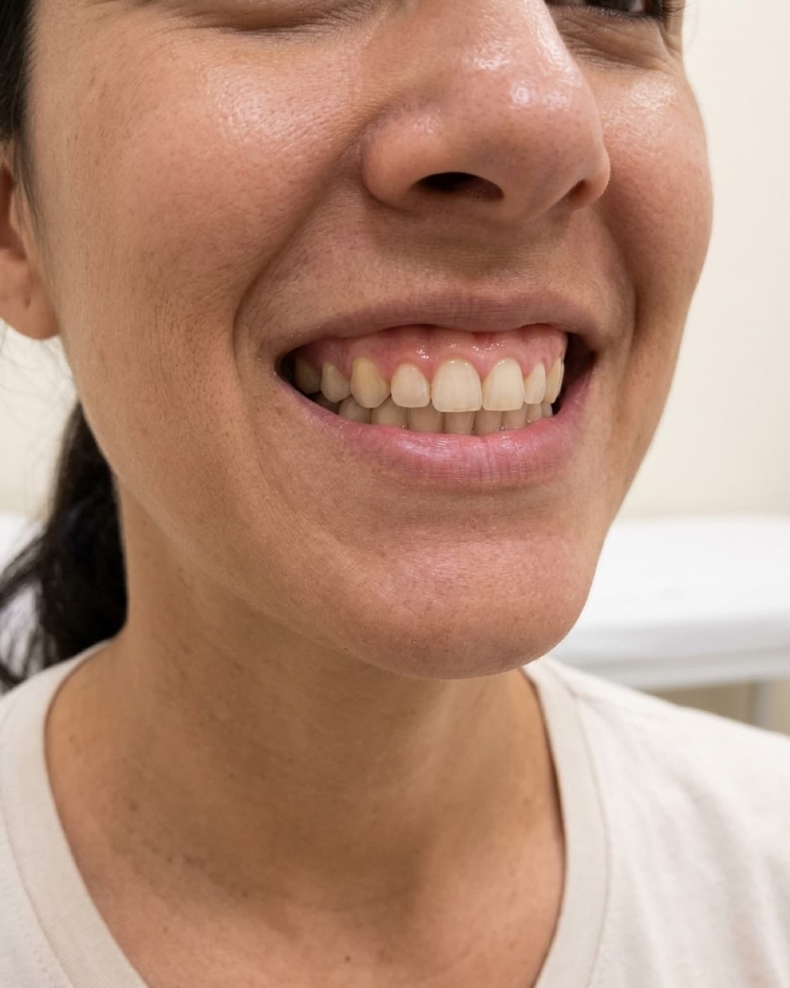 Parte inferior do rosto de uma mulher sorrindo amplamente